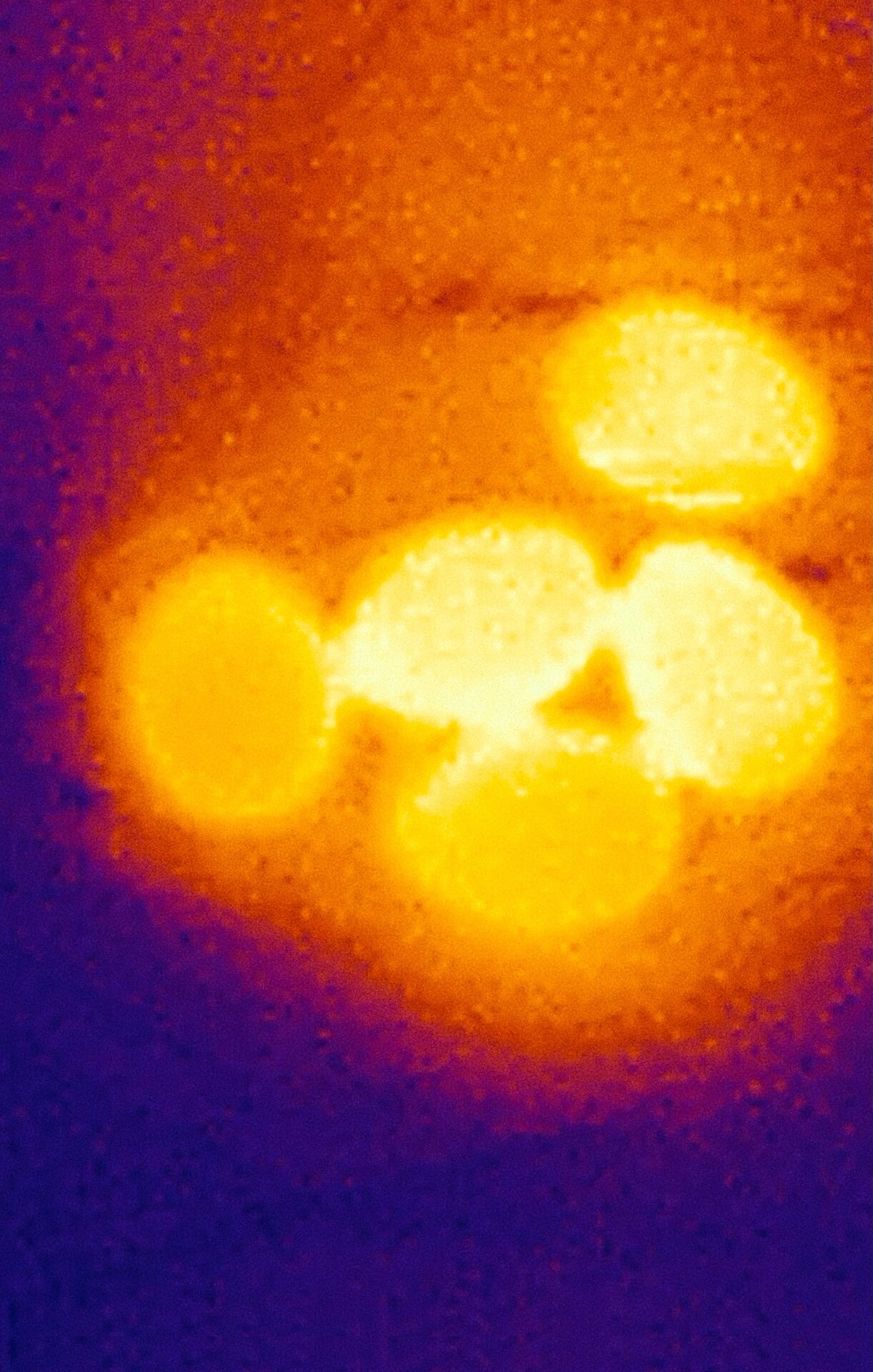 The Mind-Body Problem